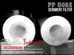 PP Core Sediment Filter Cartridge Indonesia  large